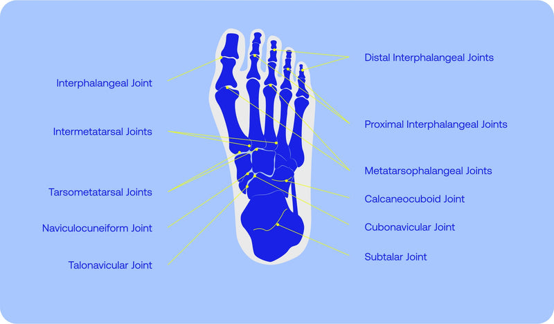 Fix Your Foundation: How Alignment Insoles Improve Posture and Performance