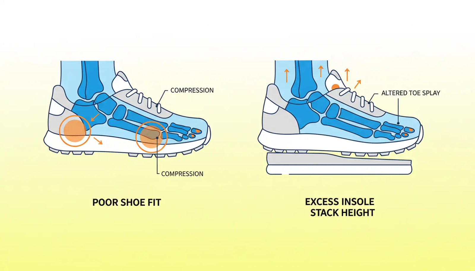 Do You Need Recovery Slippers if Your Work Shoes Already Have Arch Support?