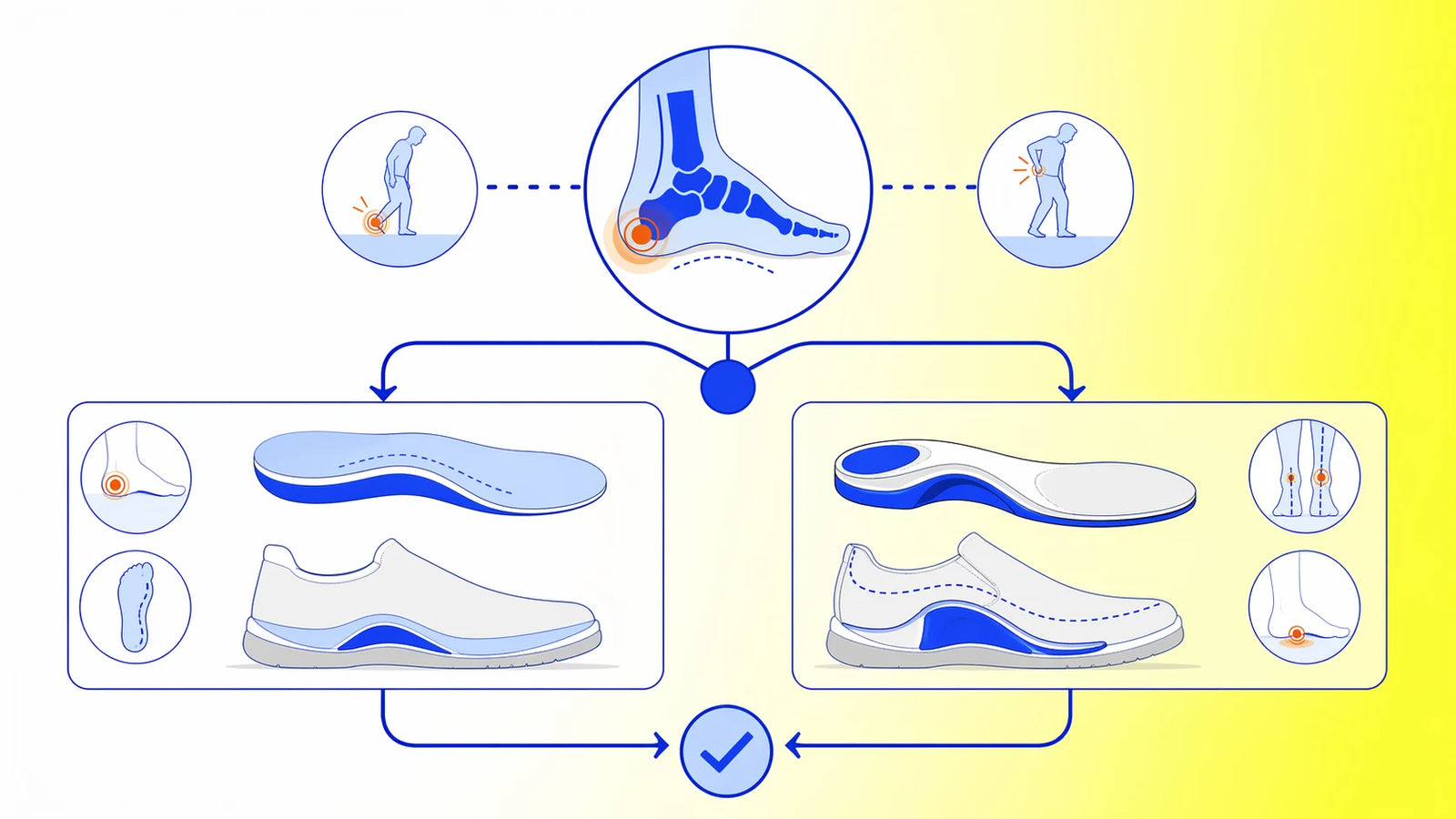 Comparison of OTC insole and orthotic decision framework for foot pain support