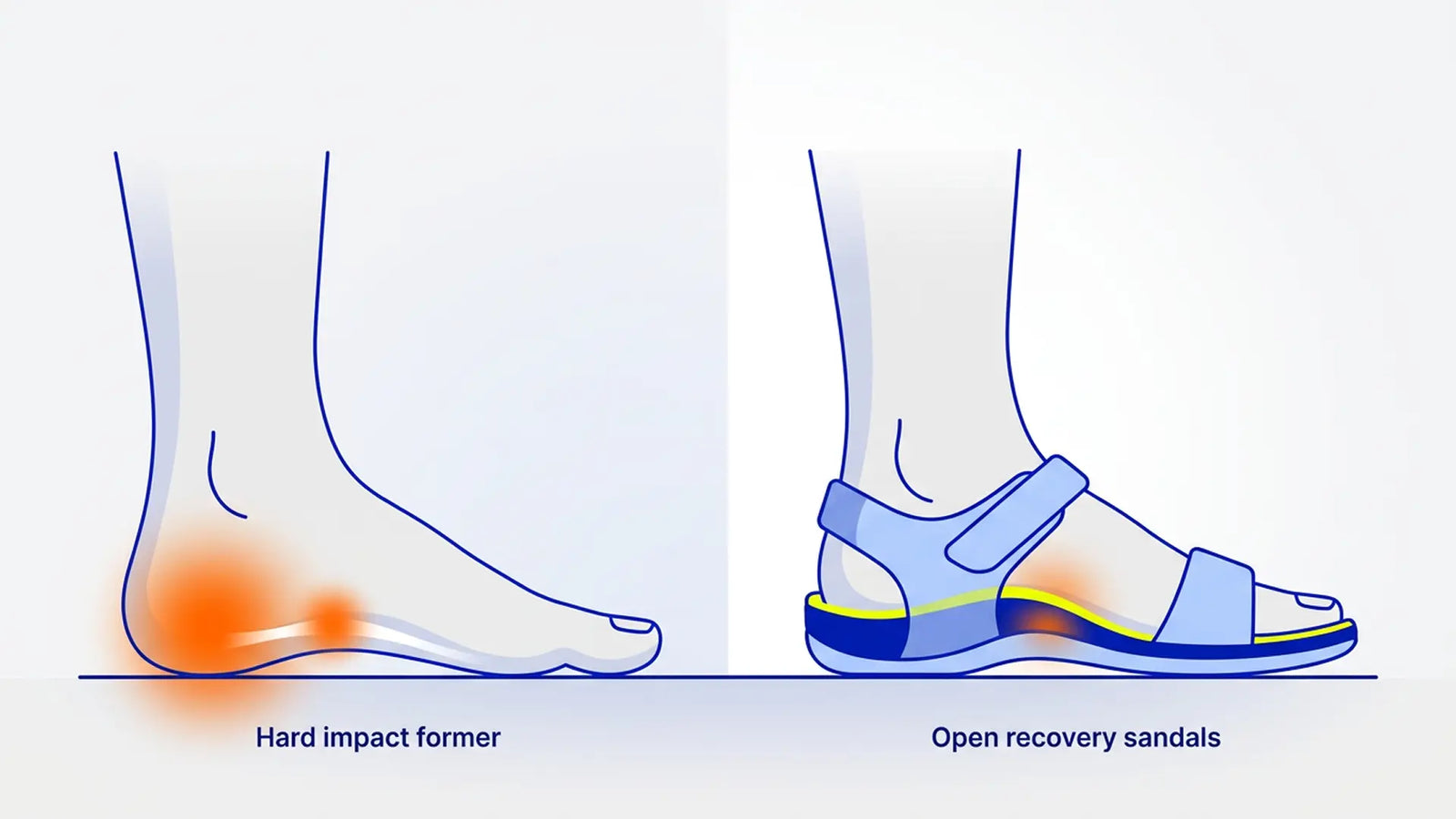 Heel spur support illustration showing repeated heel impact versus stabilized support alignment in open summer footwear