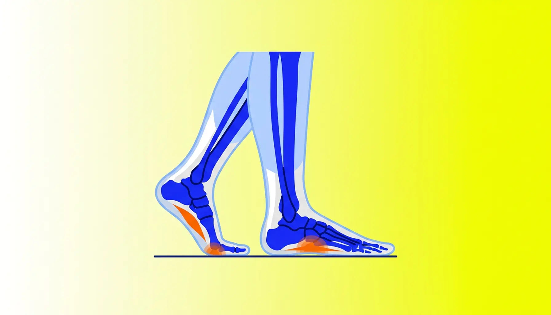 How to Tell If You Need Orthotics or OTC Insoles default cover image
