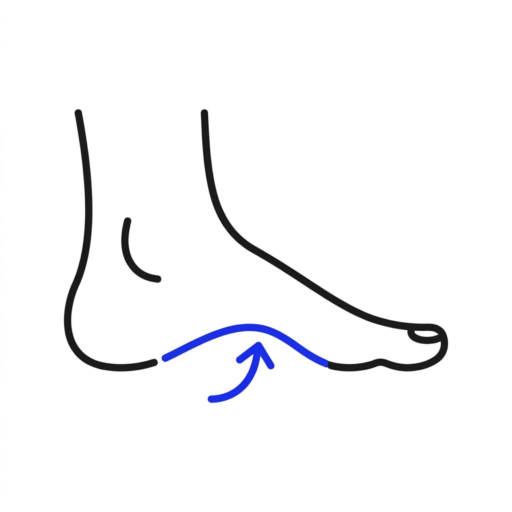 Arch Support