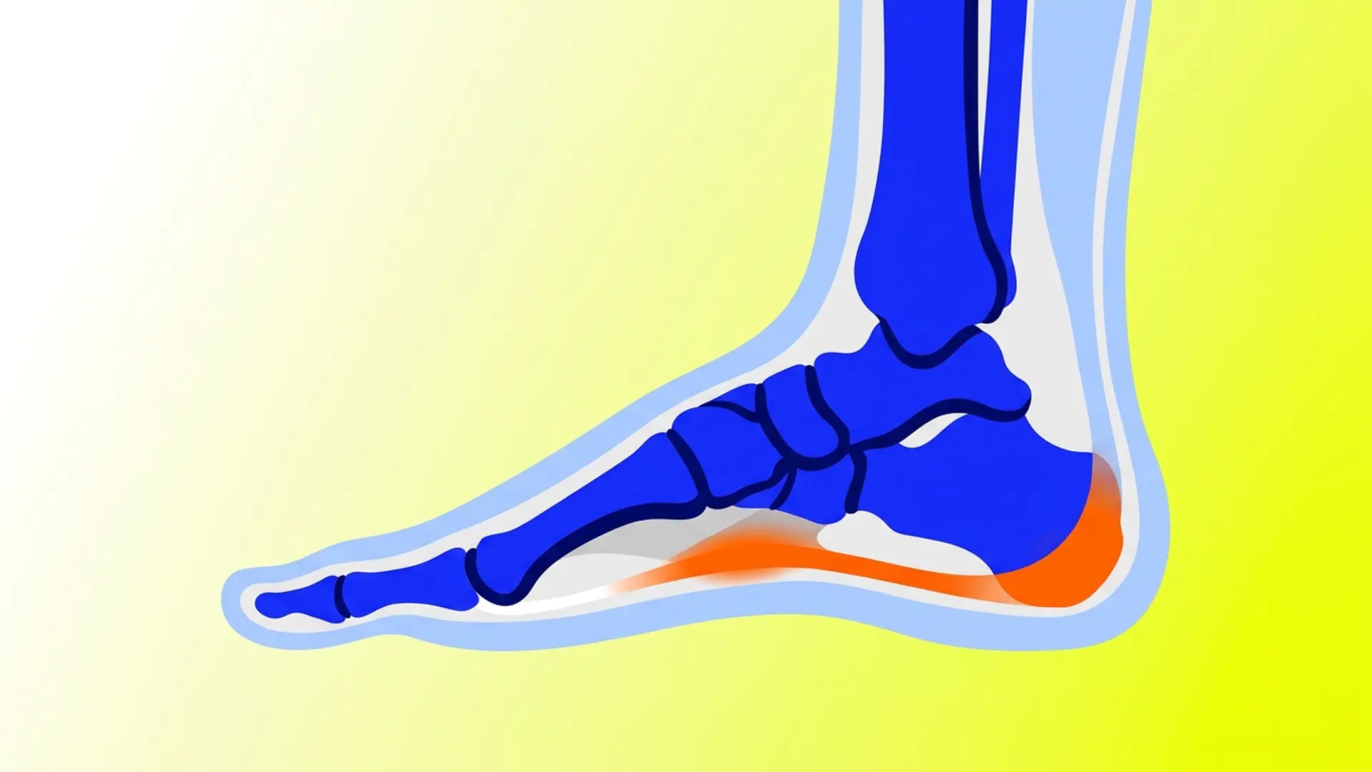 Anatomical-style vector of plantar fascia stress point in orange