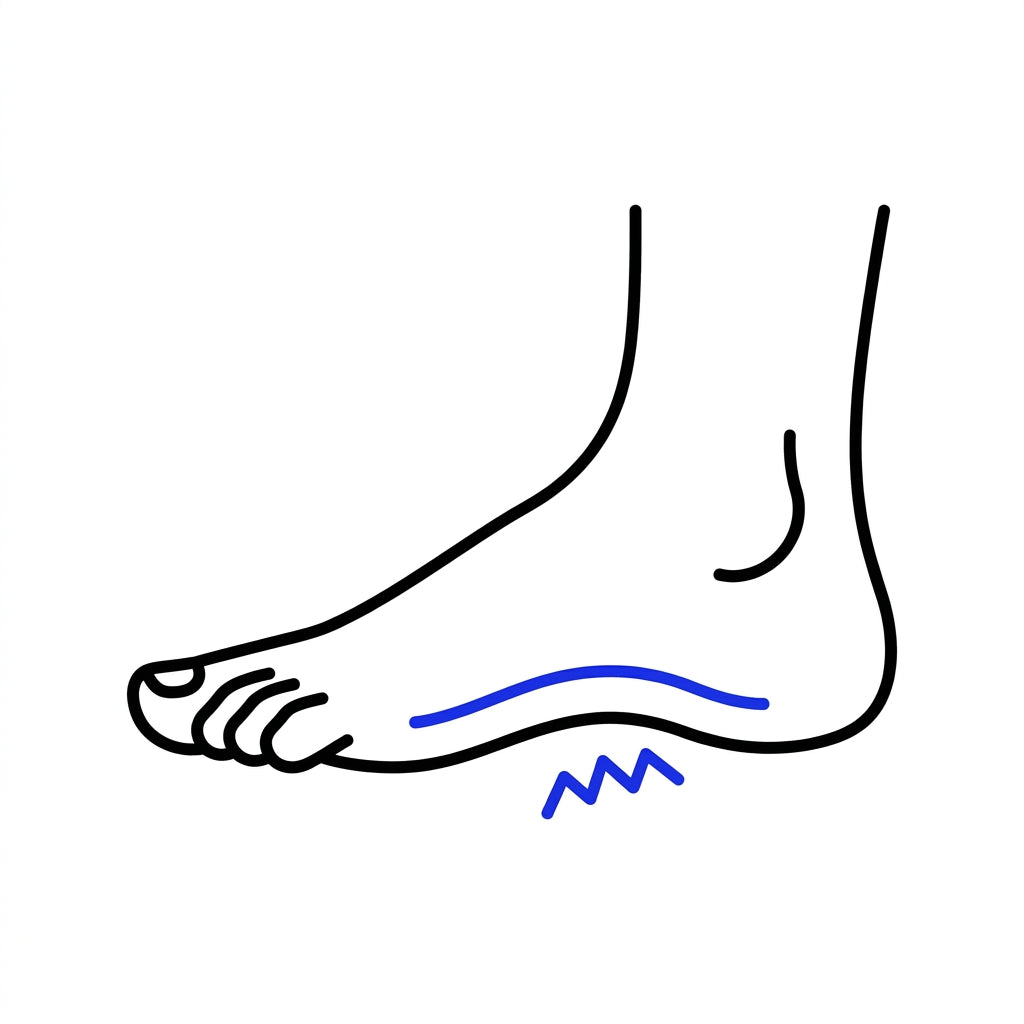 Plantar Fasciitis